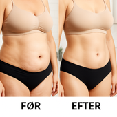 kom af med appelsinhud